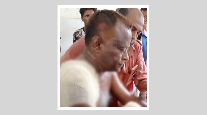 লোহাগড়ায় বিএনপি নেতার কব্জি বিচ্ছিন্ন করে দিলো দুর্বৃত্তরা