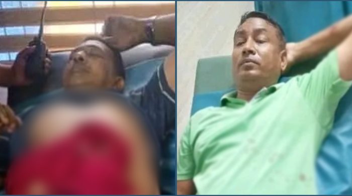 সাজাপ্রাপ্ত আসামির ছুরিকাঘাতে দুই পুলিশ আহত