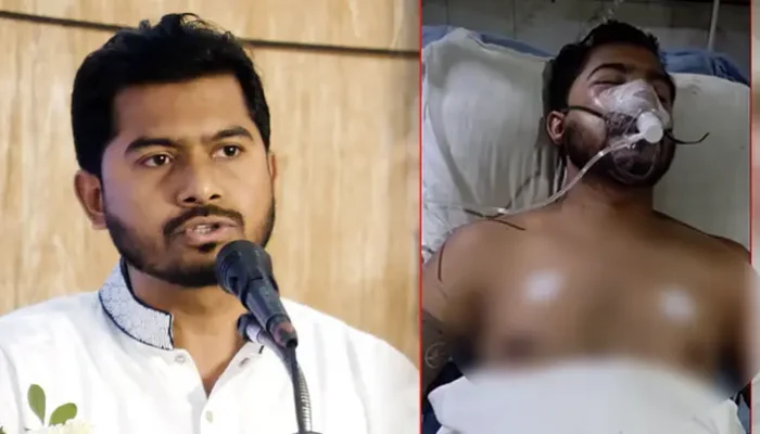নুরুল হক নুরের মস্তিষ্কে রক্তক্ষরণ, আইসিইউতে চিকিৎসাধীন