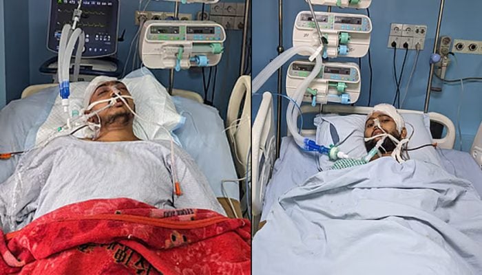 চবি সহিংসতায় গুরুতর আহত দুই শিক্ষার্থীর অবস্থা আশঙ্কাজনক