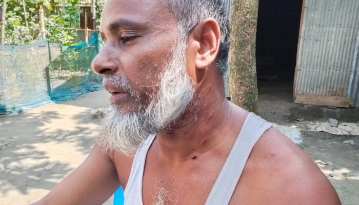 সুন্দরগঞ্জে কুকুরের কামড়ে শিশুসহ আহত ৮
